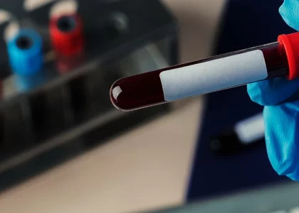 Understanding Your Blood Test Reports – What Do the Numbers Mean?