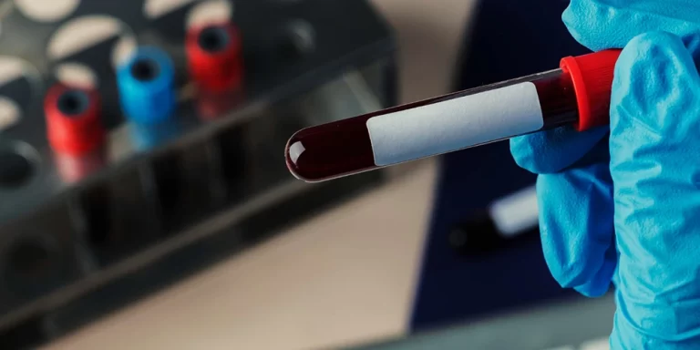 Understanding Your Blood Test Reports – What Do the Numbers Mean?